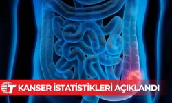 Kolon kanseri Güney Kıbrıs’ta en sık görülen üçüncü kanser türü