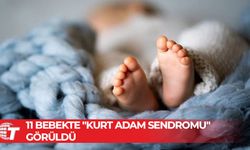 Sebebi ebeveynlerin kullandığı saç spreyi!