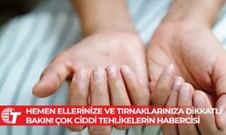 Bu haberi okurken ellerinize ve tırnaklarınıza çok dikkatli bakın!