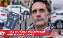 Tıraş bıçağıyla yüzünü kesti: 6 bin dolar kazandı