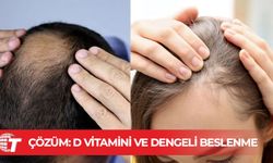 İki içecek saç dökülmesi ve erken beyazlamayı tetikliyor