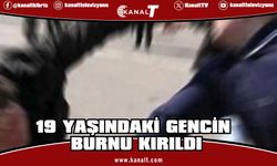 Gürültü Kavgası Kanlı Bitti