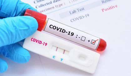 KKTC'de haftalık Koronavirüs raporları: 241 pozitif, 1 kişi hayatını kaybetti!