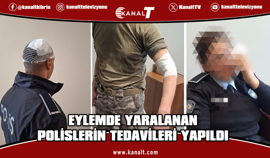 Polis Genel Müdürlüğü: Eylemde yaralanan 3 polisimizin tedavisi yapılmıştır