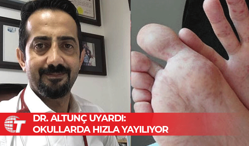 Dr. Umut Altunç: Okullarda el, ayak, ağız hastalığına dikkat!