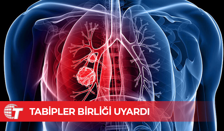 Tabipleri Birliği: Verem taramasında bilimsel yöntemlere dönülmeli