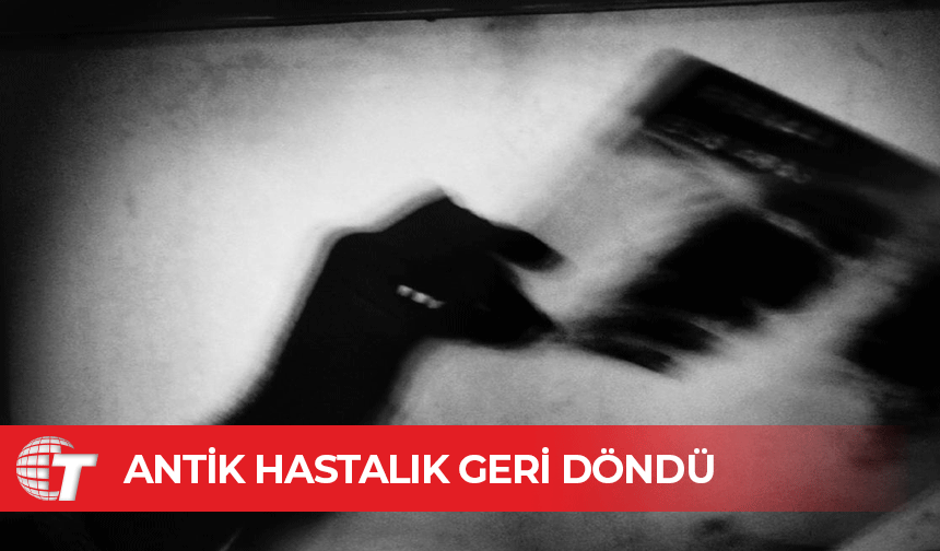 ABD’de tüberküloz salgını: Antik hastalık geri döndü