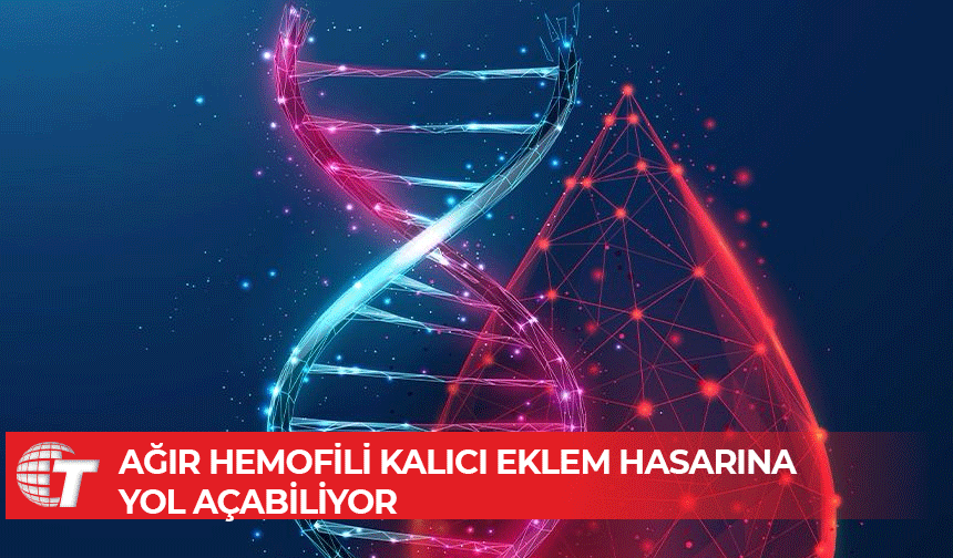 Yazman: Hemofili hastalarına yönelik yasal düzenlemeler şart