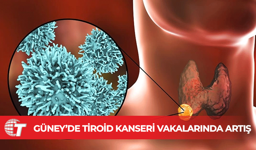 Güney Kıbrıs’ta tiroid kanseri vakalarında artış