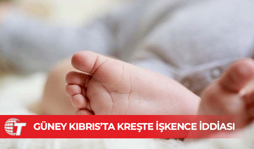 Güney Kıbrıs’ta kreşte işkence iddiası: 8 aylık bebeğin sırtında diş izleri bulundu
