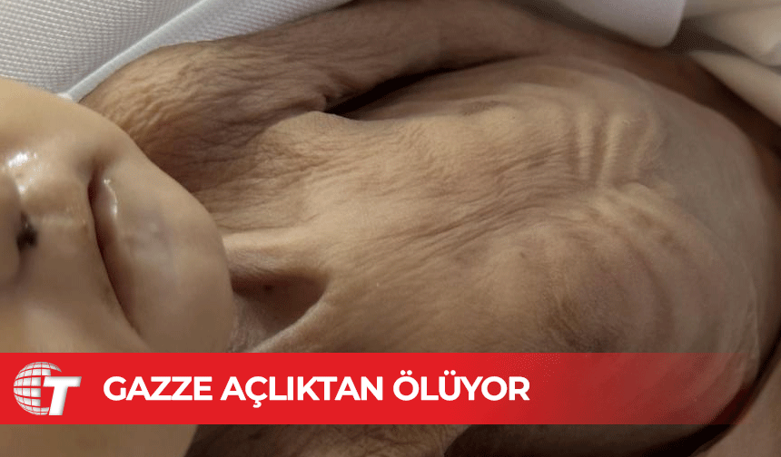Gazze'de 10 kişi daha açlıktan hayatını kaybetti